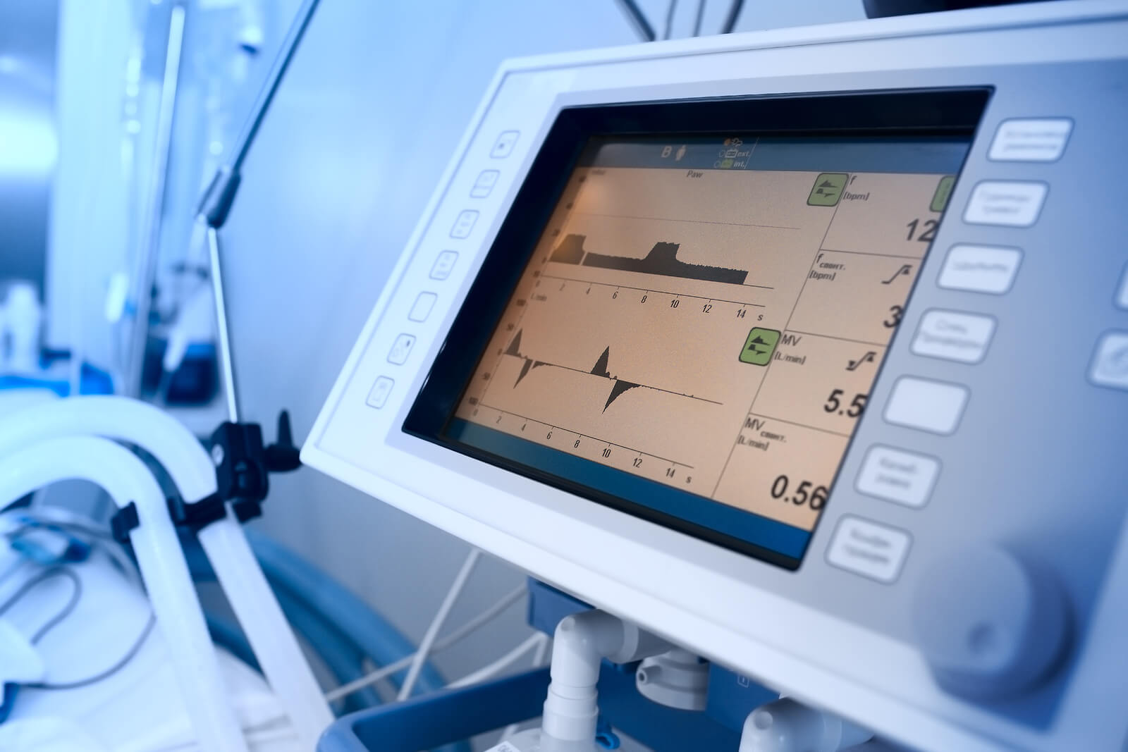 What to Expect From a Bulk-Billed Sleep Study in Adelaide