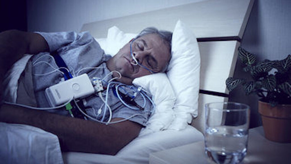sleep study cost australia